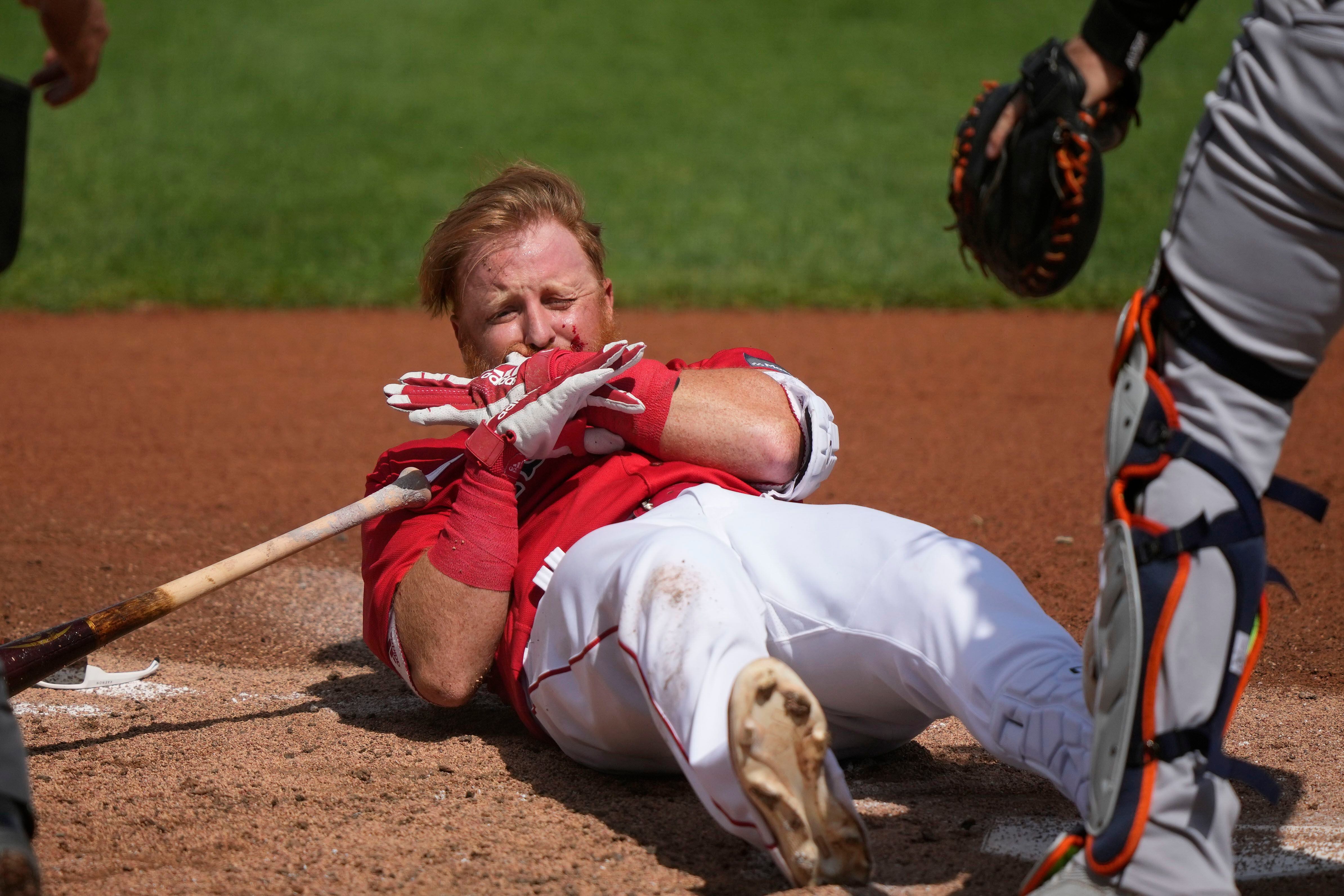 Red Sox's Justin Turner provides update after being hit in face with