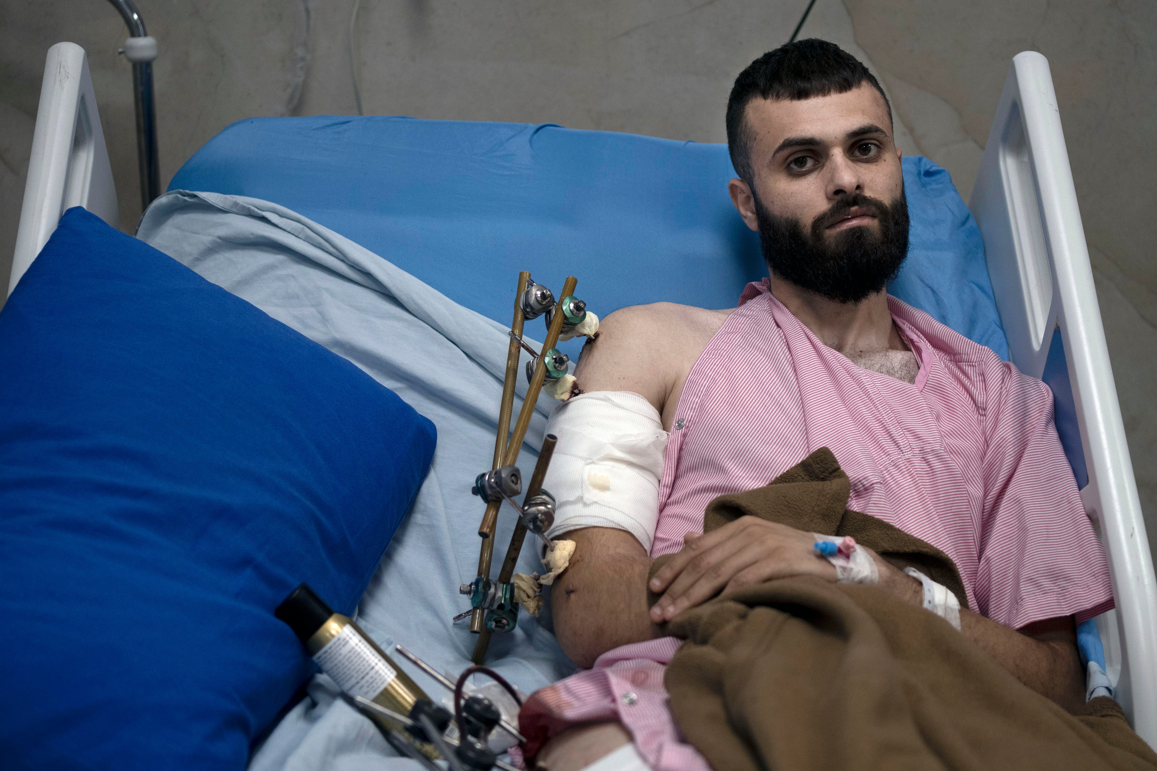 A Palestinian was shot, beaten and tied to an Israeli army jeep. The army says he posed no threat thumbnail
